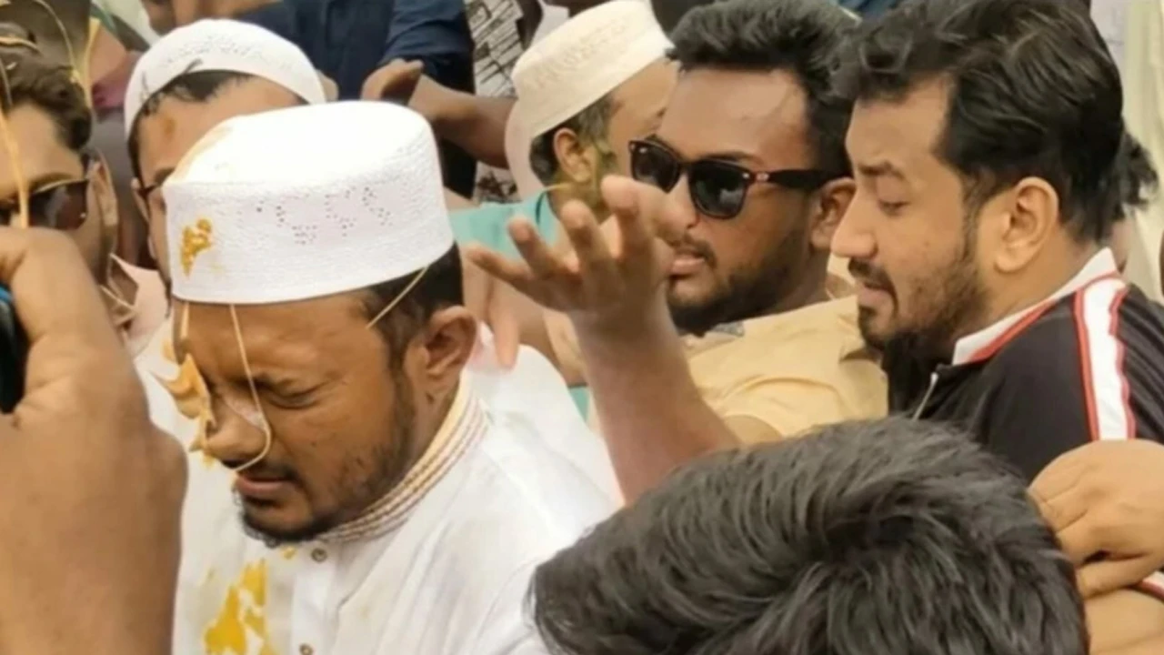 নাসীরুদ্দীন পাটোয়ারীর ওপর হামলা, ছাত্রদল নেতাসহ ৮ জনের নামে মামলা