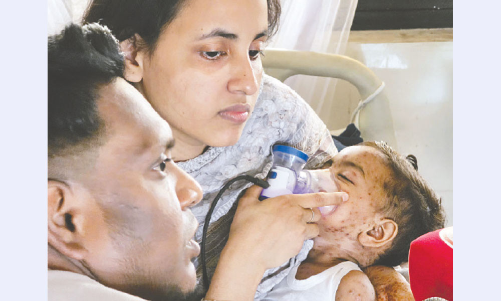 তিন মাসে হাম বেড়েছে ৭৫ গুণ