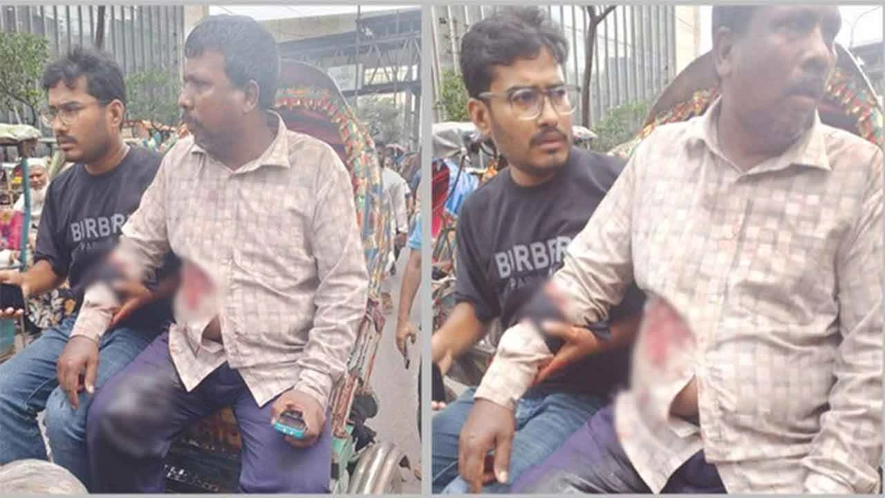 মতিঝিলে ব্যবসায়ীকে গুলি করে দেশি-বিদেশি মুদ্রাসহ ব্যাগ ছিনতাই