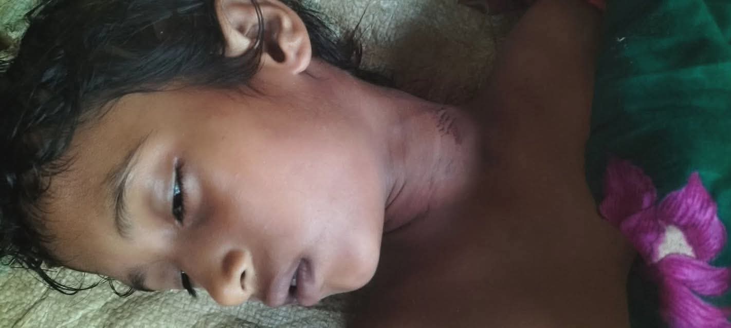 খেলতে গিয়ে গলায় ফাঁস লেগে শিশুর মর্মান্তিক মৃত্যু