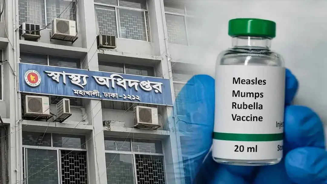 হাম ও উপসর্গে এক দিনে সর্বাধিক ১৭ শিশুর মৃত্যু