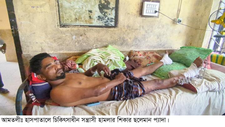 আমতলীতে হত্যা চেষ্টা মামলা তুলে না নিলে পরিবারকে এসিড দিয়ে পুড়িয়ে হত্যার হুমকি