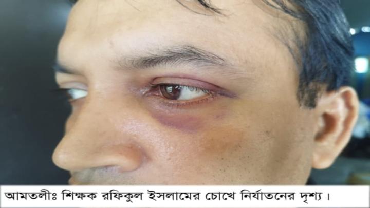 আমতলীতে স্কুল শিক্ষককে অপহরণ করে বর্বর নির্যাতন, পানির বদলে প্রস্রাব খাওয়ানোর অভিযোগ আমতলীতে স্কুল শিক্ষককে অপহরণ করে বর্বর নির্যাতন, পানির বদলে প্রস্রাব খাওয়ানোর অভিযোগ