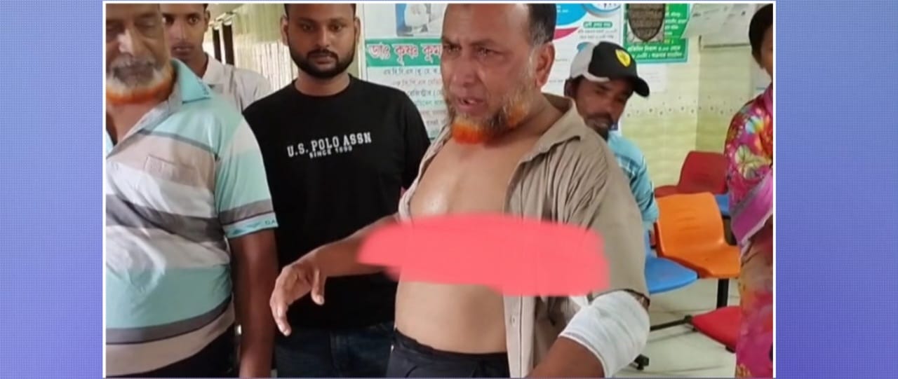 বোয়ালমারীতে দুর্বৃত্তদের হামলায় সাংবাদিক ইলিয়াস মোল্লা আহত