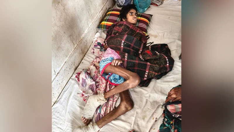 গৃহকর্মী তানিয়ার শরীরজুড়ে খুন্তির ছ্যাঁকা, মাথায় গুরুতর আঘাত, পচন ধরেছে দুই পায়ে