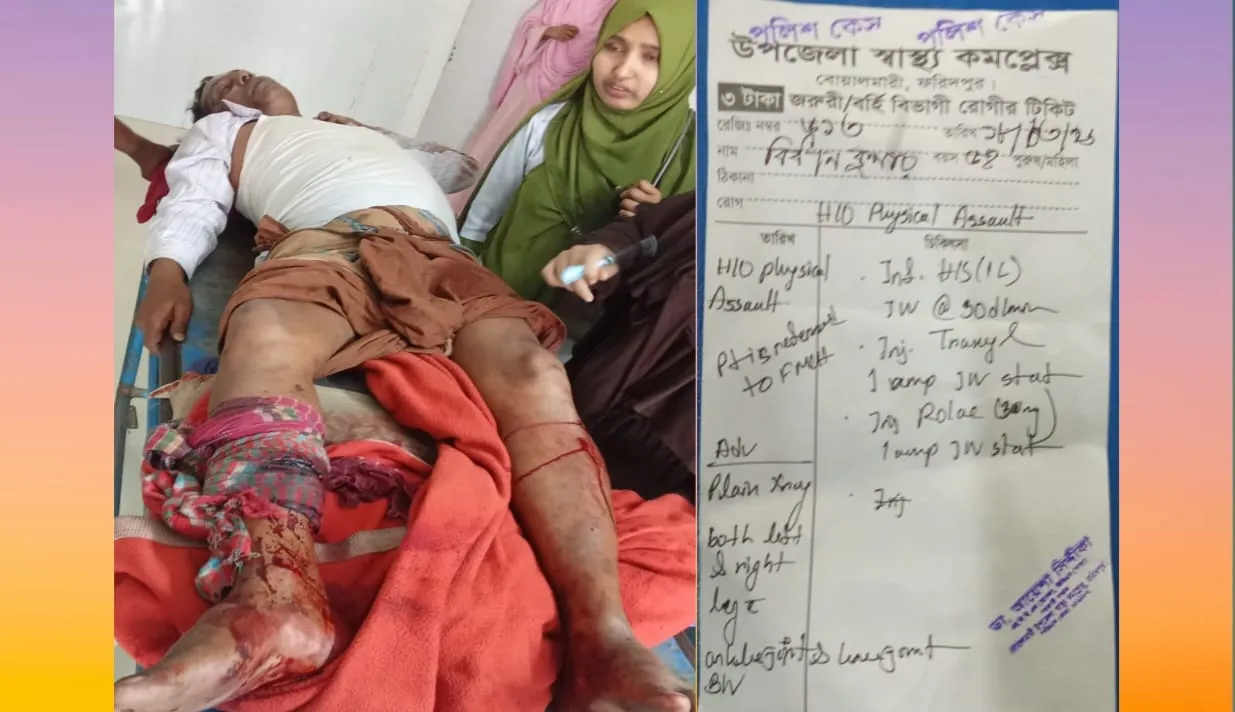 বোয়ালমারীতে আদালতে সাক্ষী দেয়ার অপরাধে এক ব্যক্তিকে হাতুড়ি পিটা আটক ৫